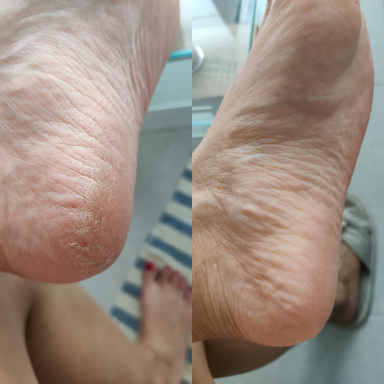 DouxTalons™ — Talons lisses en 2 minutes