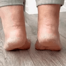DouxTalons™ — Talons lisses en 2 minutes